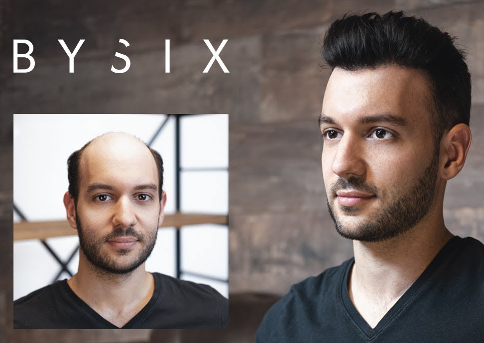 complement-capillaire-homme-hoona